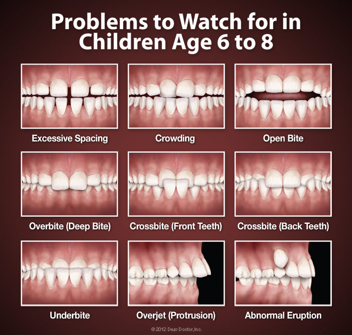 Orthodontics Problem